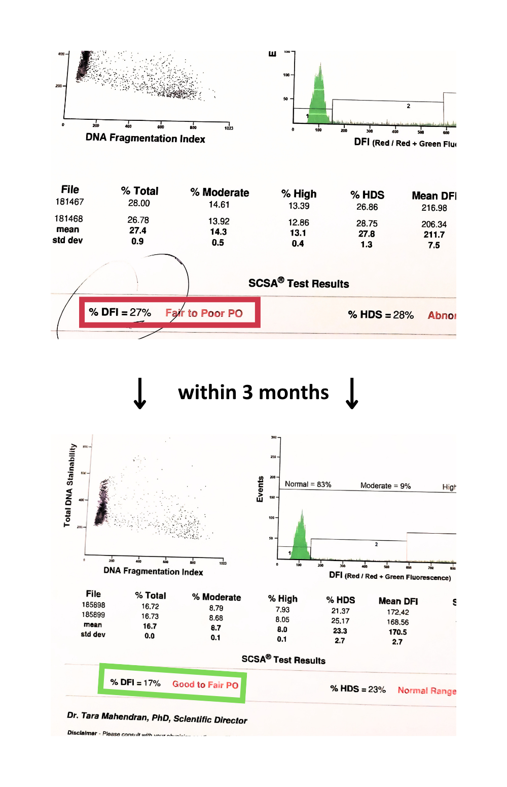 Conception screenshot — couple conceived in 46 days after improving sperm motility and DFI